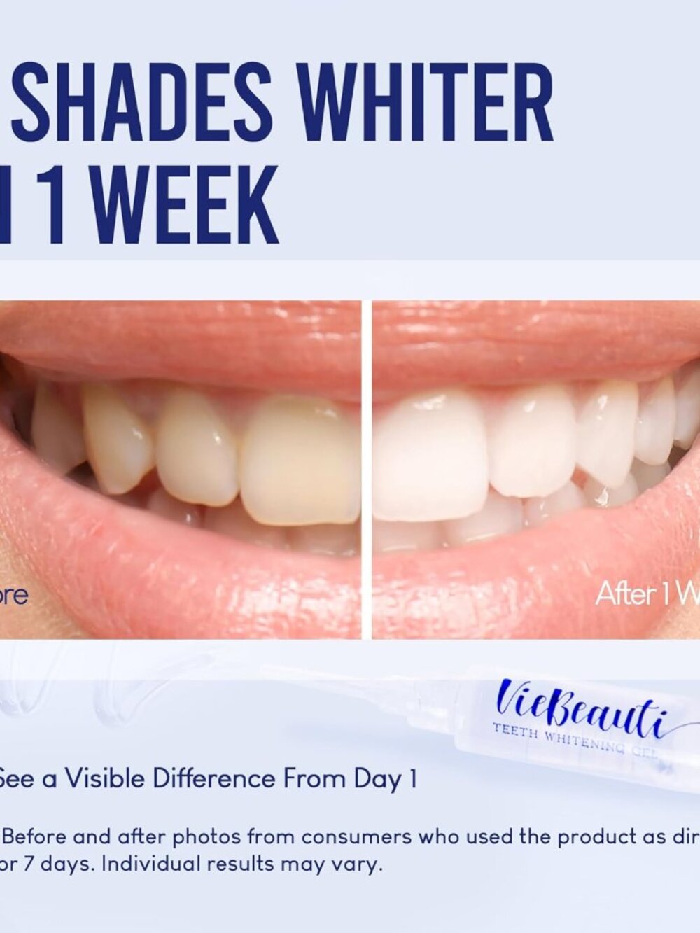 Teeth Whitening Kit with LED Light for Sensitive Teeth - Picture 2 of 8